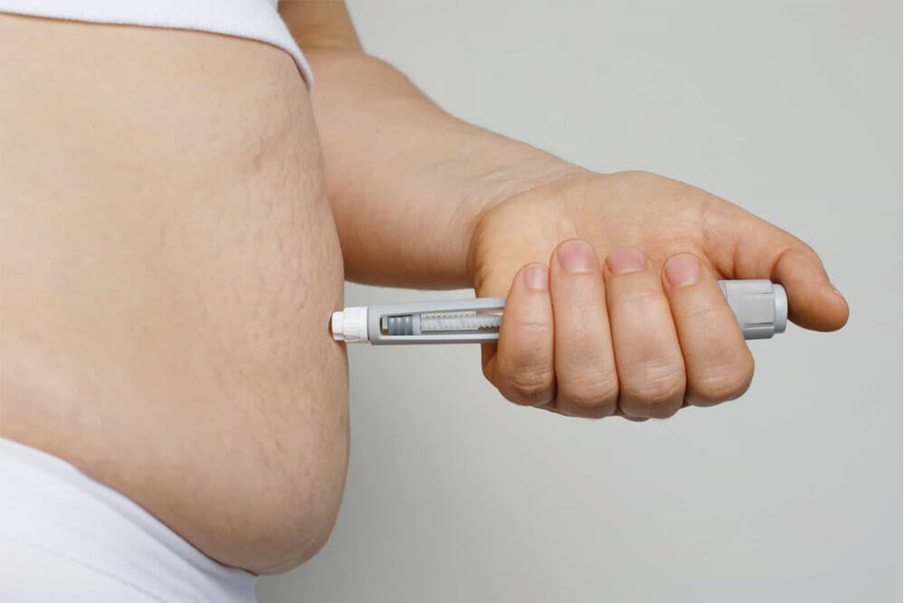 Common types of weight loss medications used for women with PCOS
