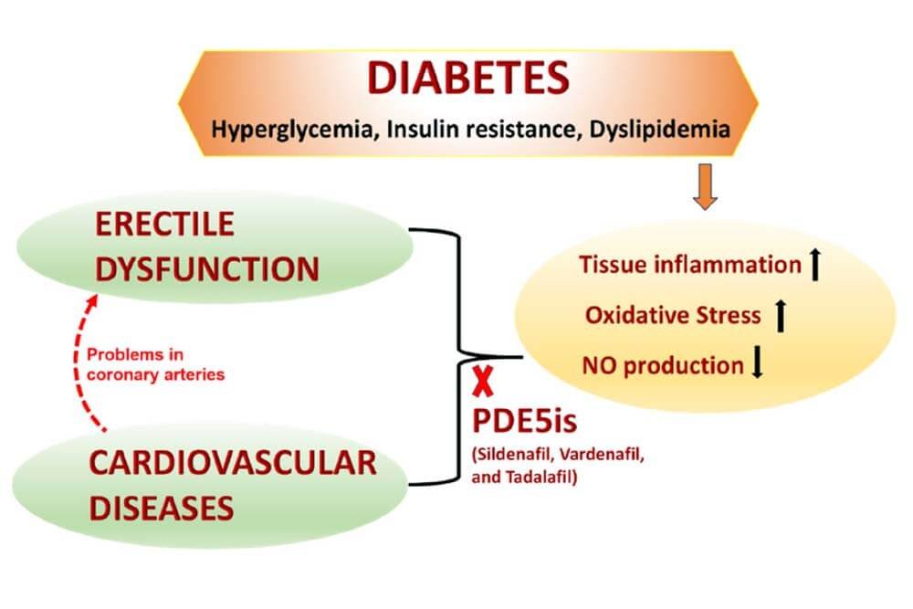 How diabetes affects erectile function and male sexual health